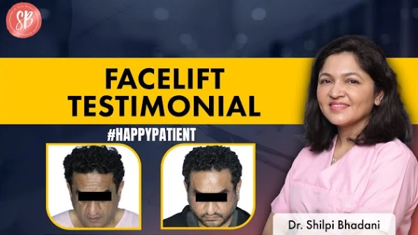 Facelift Testimonial | SB Aesthetics | Dr. Shilpi Bhadani